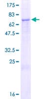Human ZSWIM1 Protein (Recombinant GST)