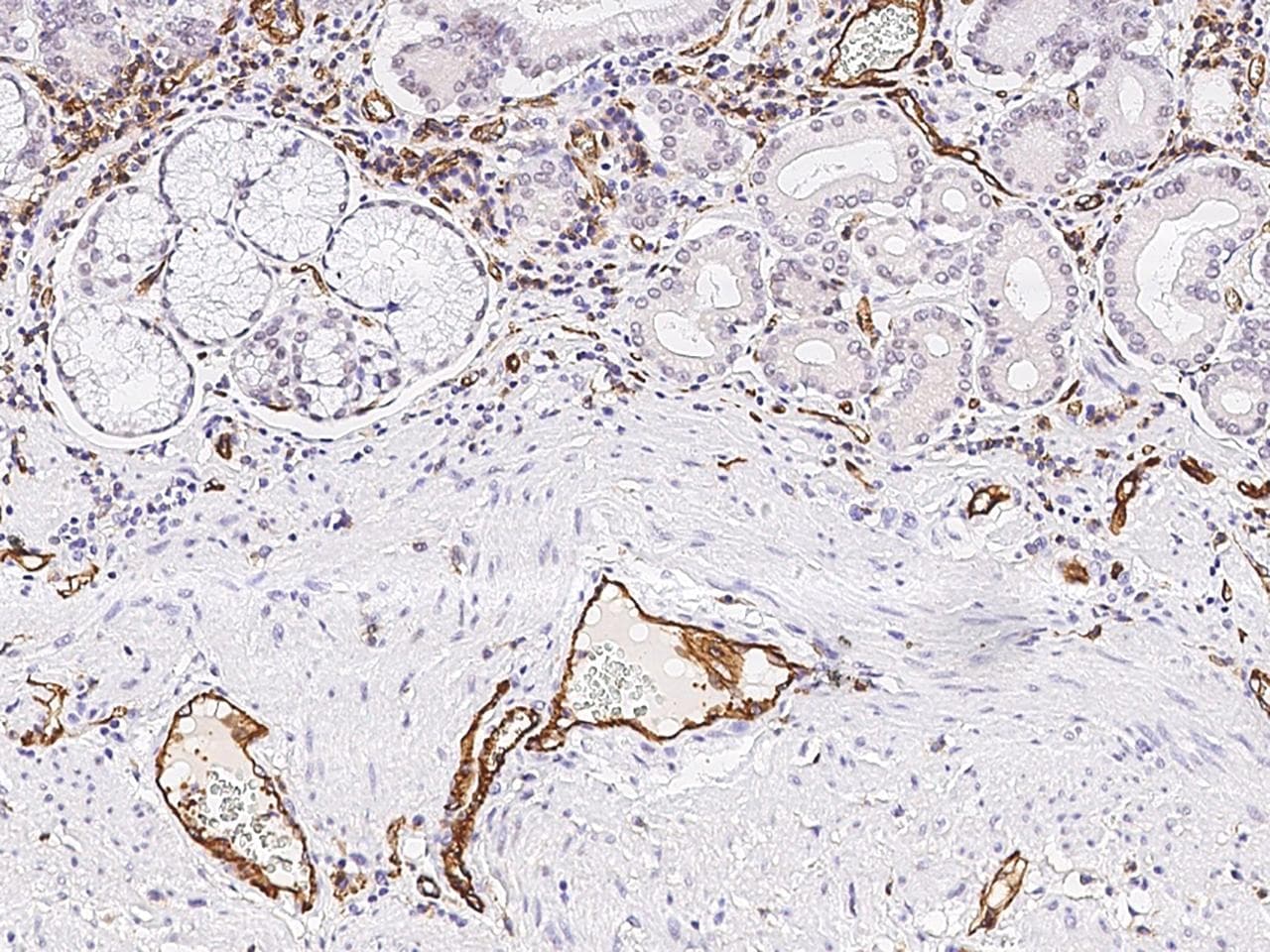 Monoclonal Rabbit anti-Human PECAM-1 / CD31 Antibody (clone 311, Preservative Free, IHC)