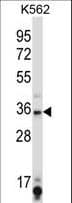 SIRT6 / Sirtuin 6 Antibody (aa276-305)