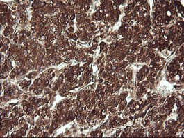 REEP5 Antibody (clone OTI4D2)
