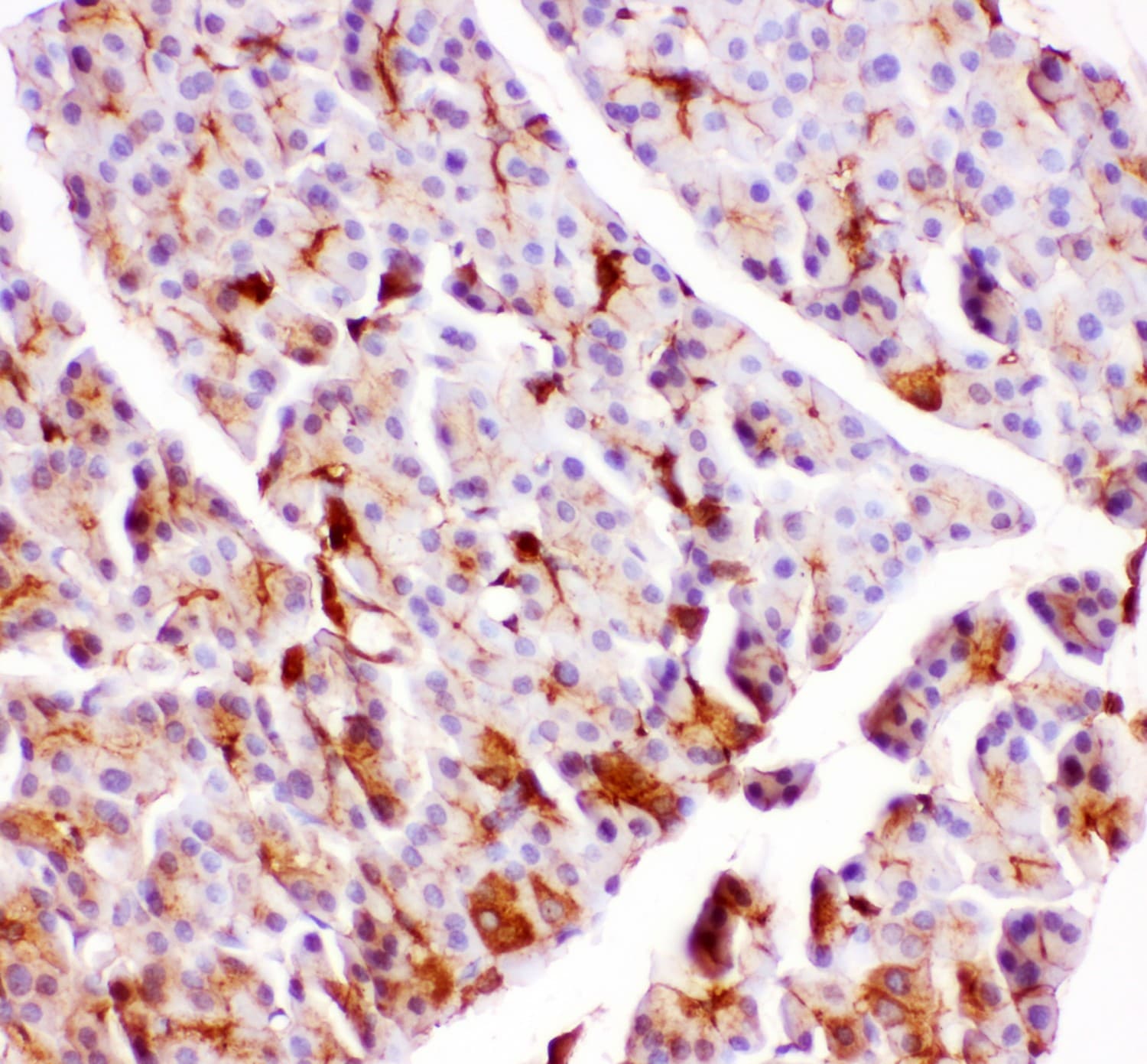 Polyclonal Rabbit anti-Human GPX1 / Glutathione Peroxidase Antibody (aa116-146, IHC, WB)