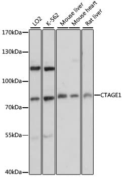 CTAGE1 / CTAGE Antibody