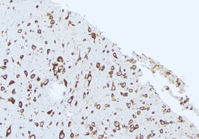 APOL2 / Apolipoprotein L 2 Antibody
