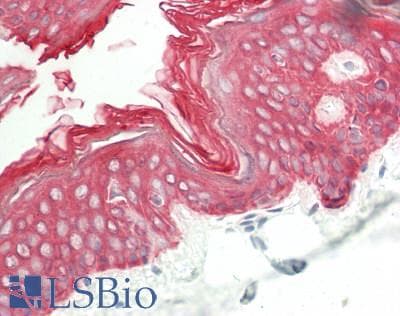 KRT2 / CK2 / Cytokeratin 2 Antibody (aa351-400, FITC)