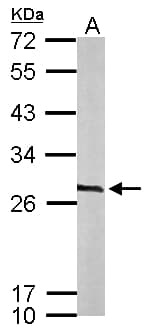 Polyclonal Rabbit anti-Human CACYBP Antibody (aa1-228, WB)
