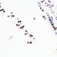 Polyclonal Rabbit anti-Human CXXC1 / CGBP Antibody (IHC, IF, WB)