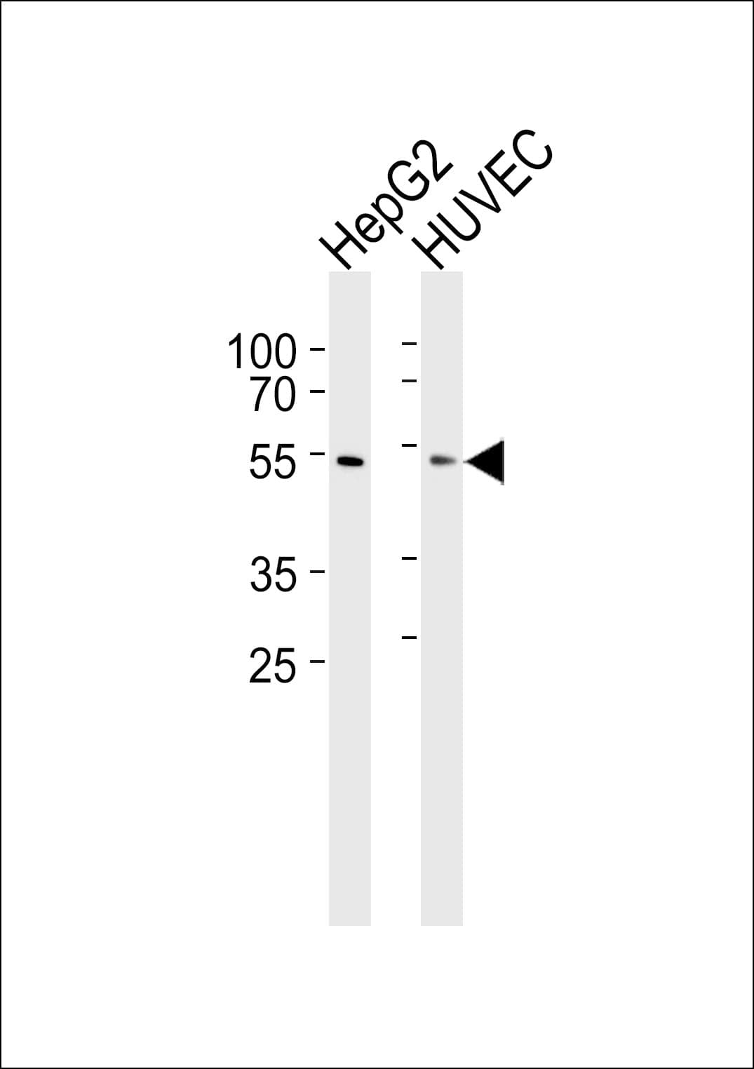 SUV39H2 Antibody (aa93-122)