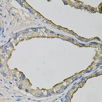 LCN1 / Lipocalin-1 Antibody