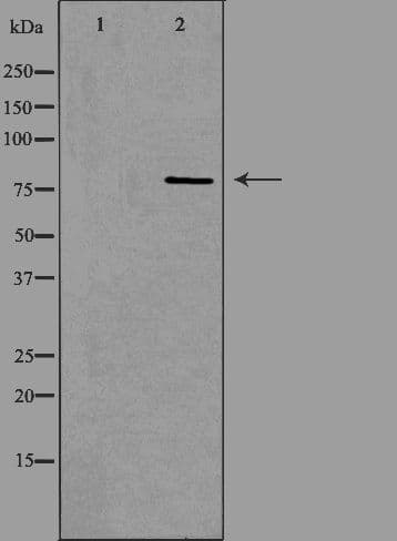 ADAR2 / ADARB1 Antibody