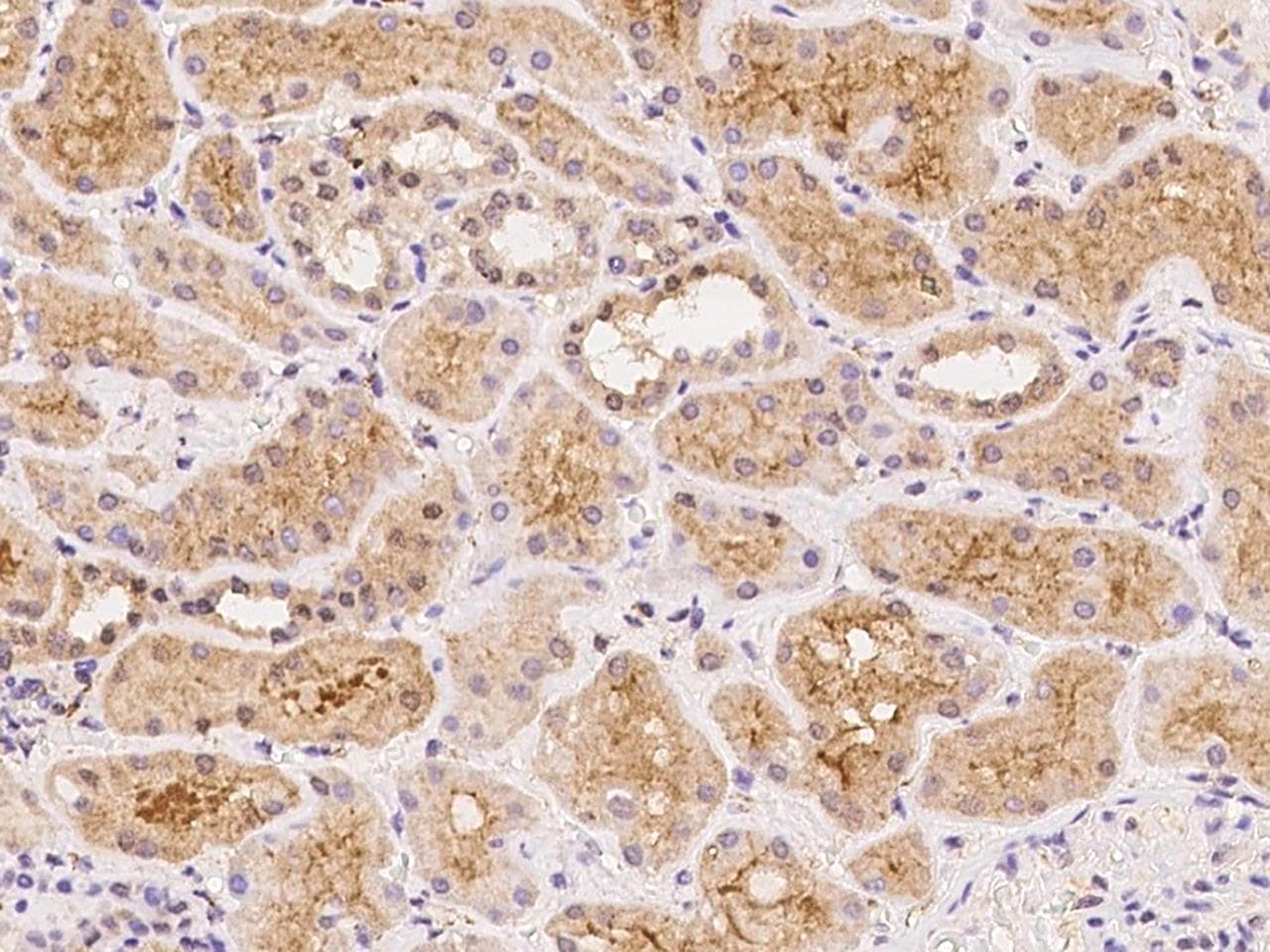 NLRP5 / NALP5 Antibody