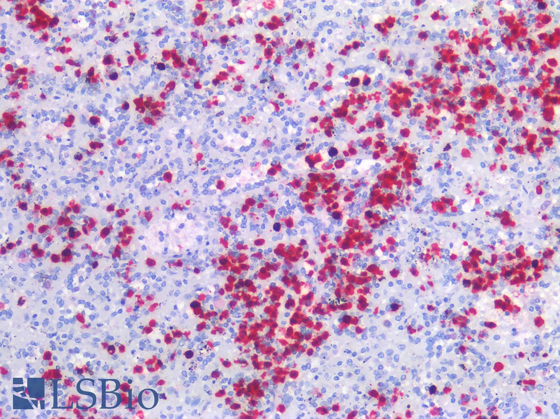 PathPlus™ Monoclonal Mouse anti-Human S100A8 / MRP8 Antibody (clone MAC 387, Azide-free, IHC)