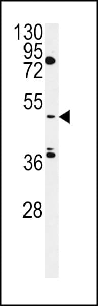 Polyclonal Rabbit anti-Human CLNK Antibody (aa281-308, WB)