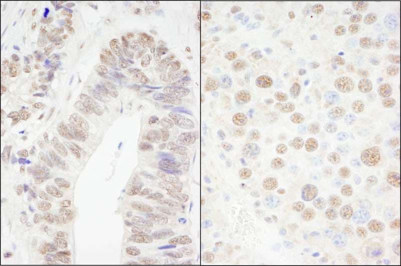 IHC-plus™ CPSF6 Antibody (aa501-551)