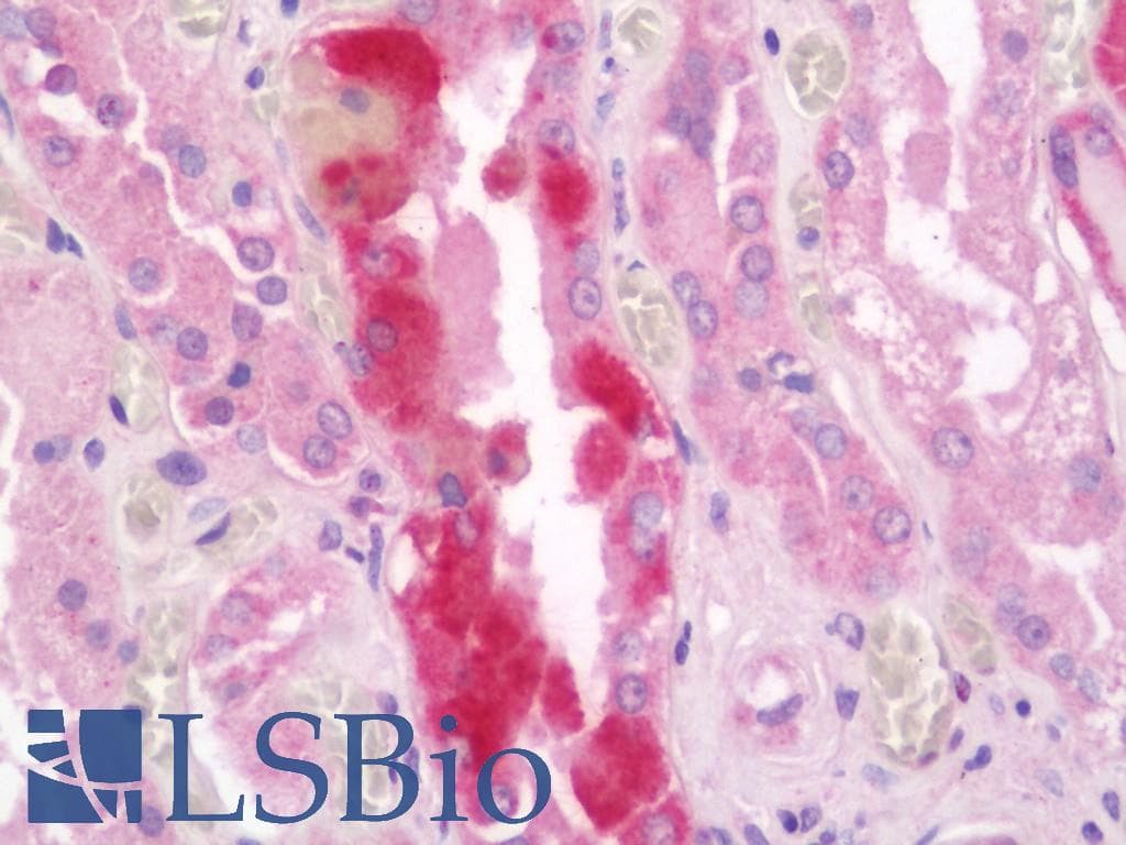 IHC-plus™ Polyclonal Rabbit anti-Human INPP5A Antibody (aa128-330, IHC, WB)