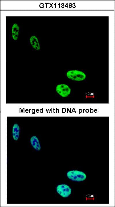 HNRNPC / HNRNP C Antibody (aa1-142)