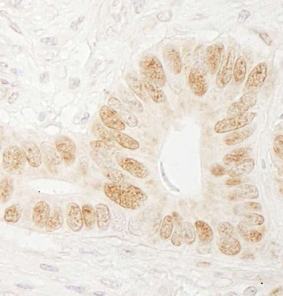 CHTF18 / RUVBL Antibody (aa25-75)