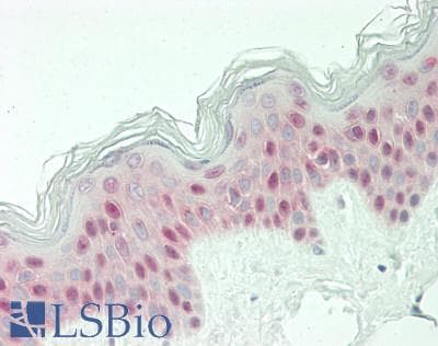 IHC-plus™ MYB / c-Myb Antibody (N-Terminus)