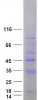 Human STK19 Protein (Recombinant Myc-DDK (Flag))