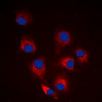 BCL2L11 / BIM Antibody (phospho-Ser69)