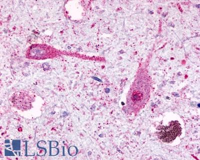 PathPlus™ Polyclonal Rabbit anti-Human FKSG80 / GPR81 Antibody (C-Terminus, IHC)