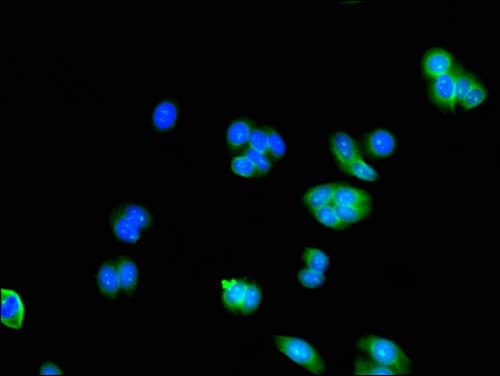 Polyclonal Rabbit anti-Human AK5 / Adenylate Kinase 5 Antibody (IHC, IF, WB)