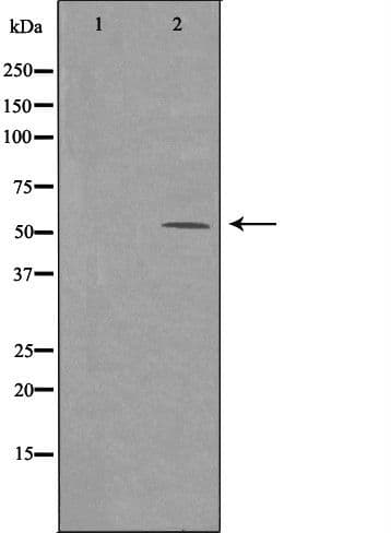 ARMC6 Antibody