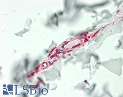IHC-plus™ IL11 Antibody