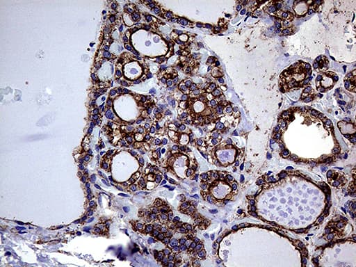 GNAS Antibody (clone OTI7A6)