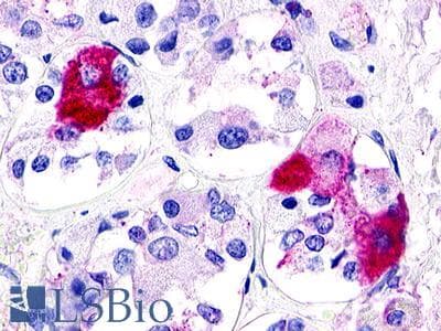 PathPlus™ Polyclonal Rabbit anti-Human GPR21 Antibody (Transmembrane Domain, IHC)