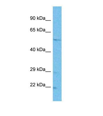Polyclonal Rabbit anti-Human TTC26 Antibody (aa46-95, WB)