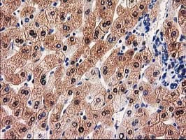 GALE / UDP-Glucose 4-Epimerase Antibody (clone OTI1C4)