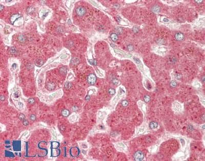 IHC-plus™ PH / PAH Antibody (C-Terminus)