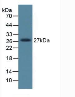 DKK1 Antibody