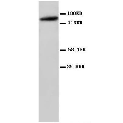 GRIN2A / NMDAR2A / NR2A Antibody (aa1411-1427)
