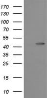 MAP2K1 / MKK1 / MEK1 Antibody (clone OTI1A10)
