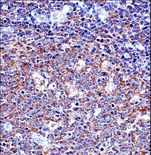 SPN / CD43 Antibody (aa32-60)