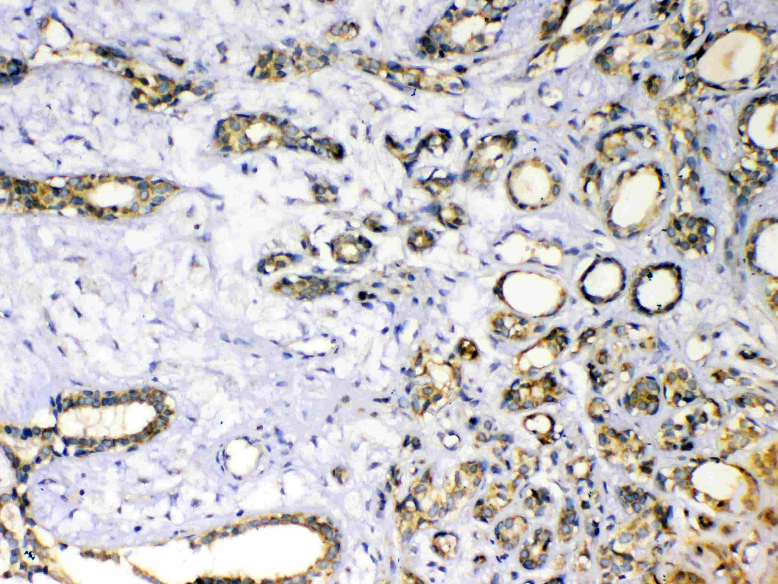 SOD3 Antibody
