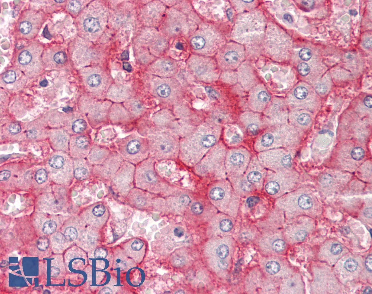 IHC-plus™ SLC22A1 Antibody (clone 2C5)