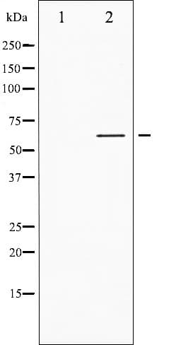 Polyclonal Rabbit anti-Human p56lck / LCK Antibody (phospho-Tyr505, IHC, IF, WB)
