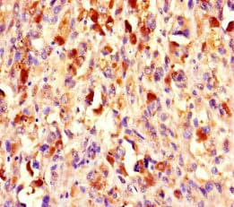 Polyclonal Rabbit anti-Human CHD4 Antibody (IHC, IF)
