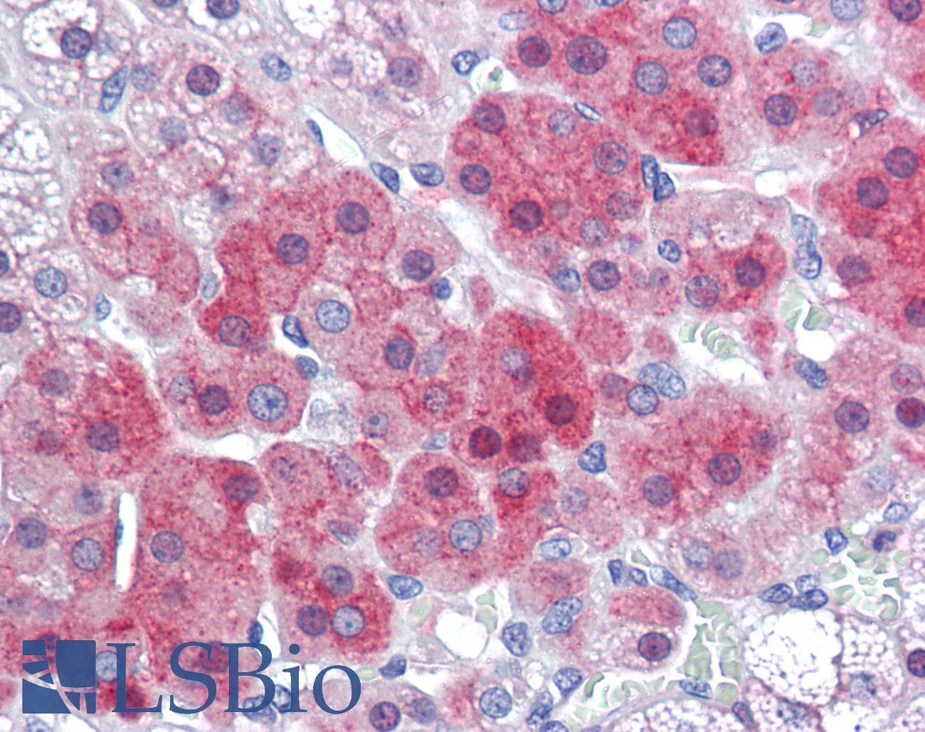 IHC-plus™ Polyclonal Rabbit anti-Human CRHR2 / CRF2 Receptor Antibody (aa71-120, IHC, WB)