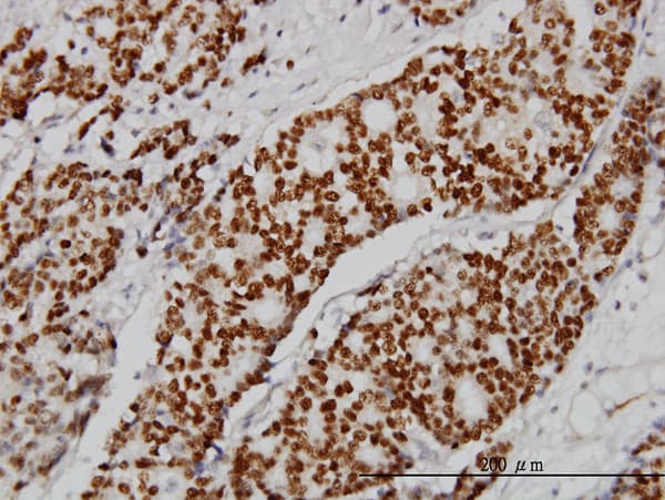PR / Progesterone Receptor Antibody (clone 5D10)
