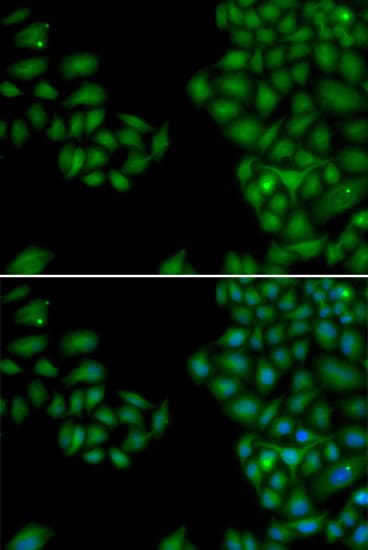 NF-L / NEFL Antibody