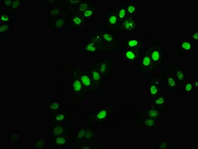 HIST1H2BN Antibody