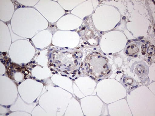 GARS / Glycyl tRNA Synthetase Antibody (clone OTI4G4)