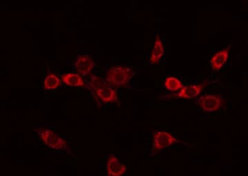 NEGR1 / Neurotractin Antibody