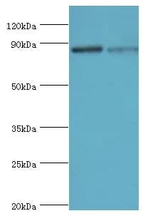 ERCC2 / XPD Antibody (aa1-300)