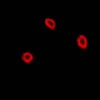 Polyclonal Rabbit anti-Human NPC2 Antibody (IF, WB)