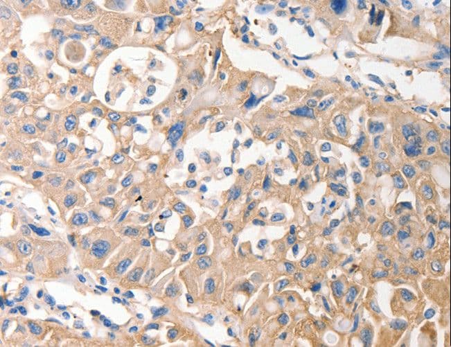 MVP / VAULT1 Antibody