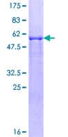Human SIAH2 Protein (Recombinant GST)